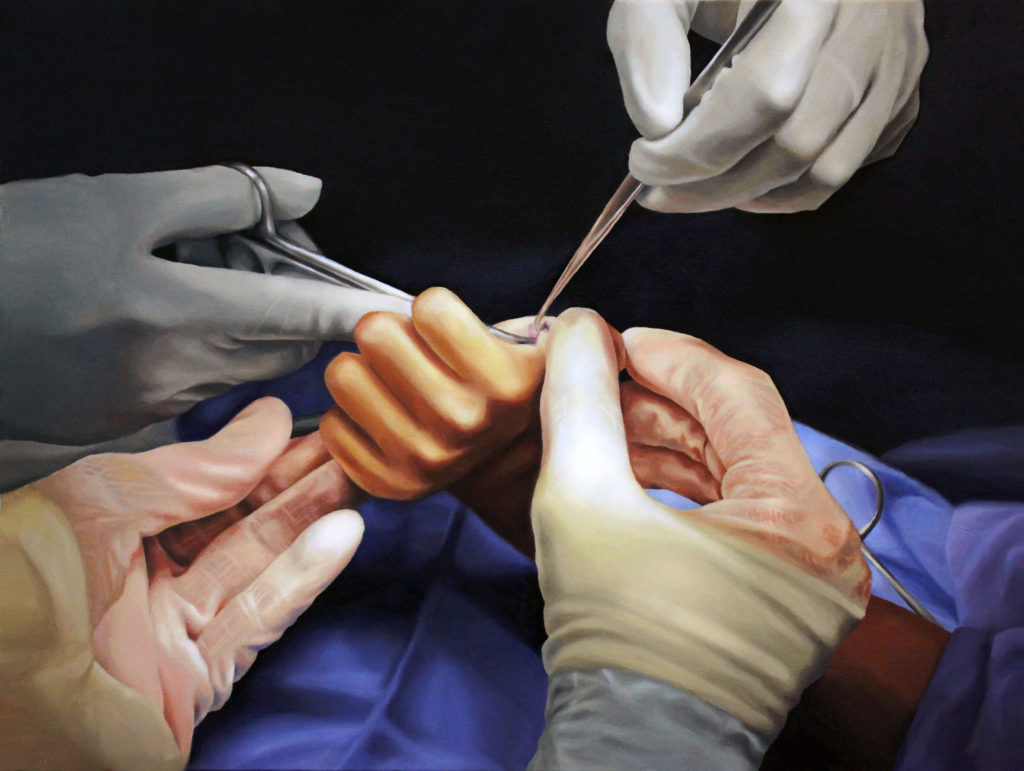 The Surgical Stage, Oil on Canvas